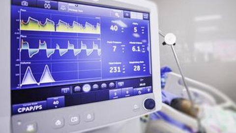Pabrikan Mobil, Tim Balap F1 hingga Pabrik Pesawat Bantu Produksi Ventilator