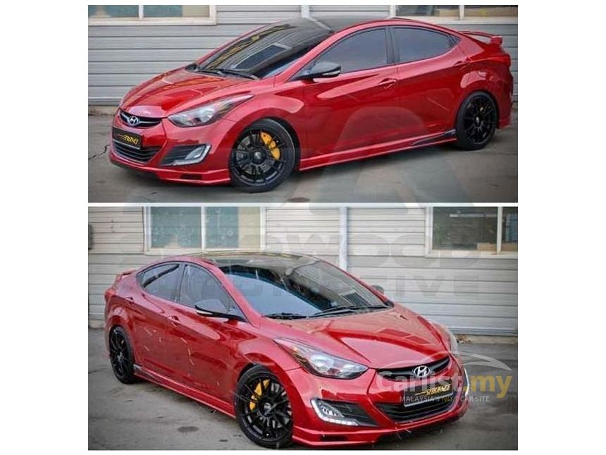 body kit elantra 2015